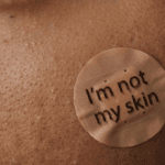 Why Your Acne Won’t Go Away – 7 Hidden Causes You’re Ignoring