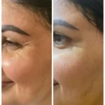 Peptides Skincare: The 2026 Anti-Aging Breakthrough Everyone’s Talking About