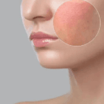 How to Repair Your Skin Barrier Naturally: A Complete Science-Backed Guide