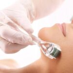 Liquid Microneedling Explained: The Biotech Anti-Aging Trend Everyone Is Talking About in 2026