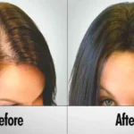 Illustration showing the stages of the human hair growth cycle.