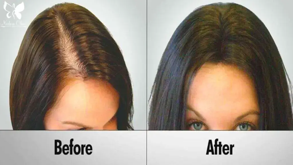 Illustration showing the stages of the human hair growth cycle.